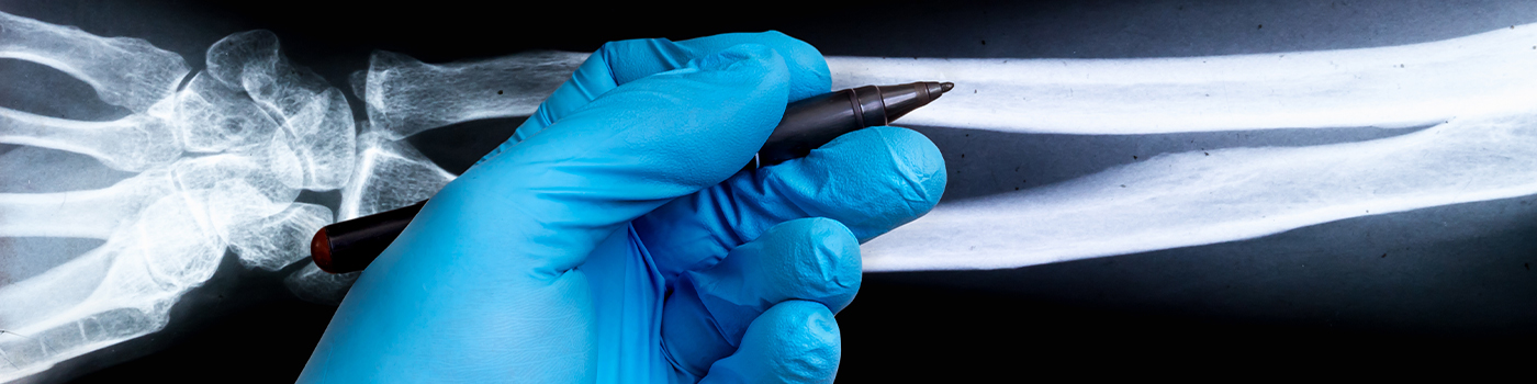 Our Services-Osteomyelitis-Bone Infections